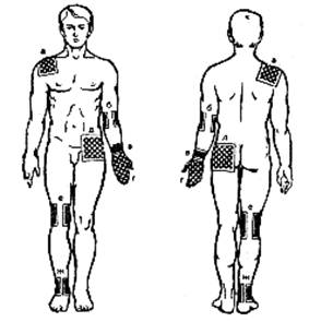 Эффективность применения геля «Ферменкол» в сочетании с электрофорезом при рубцах и шрамах